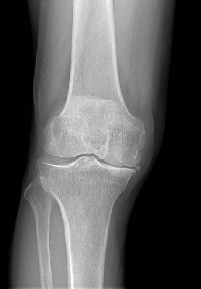 Traumatología y cirugía ortopédica